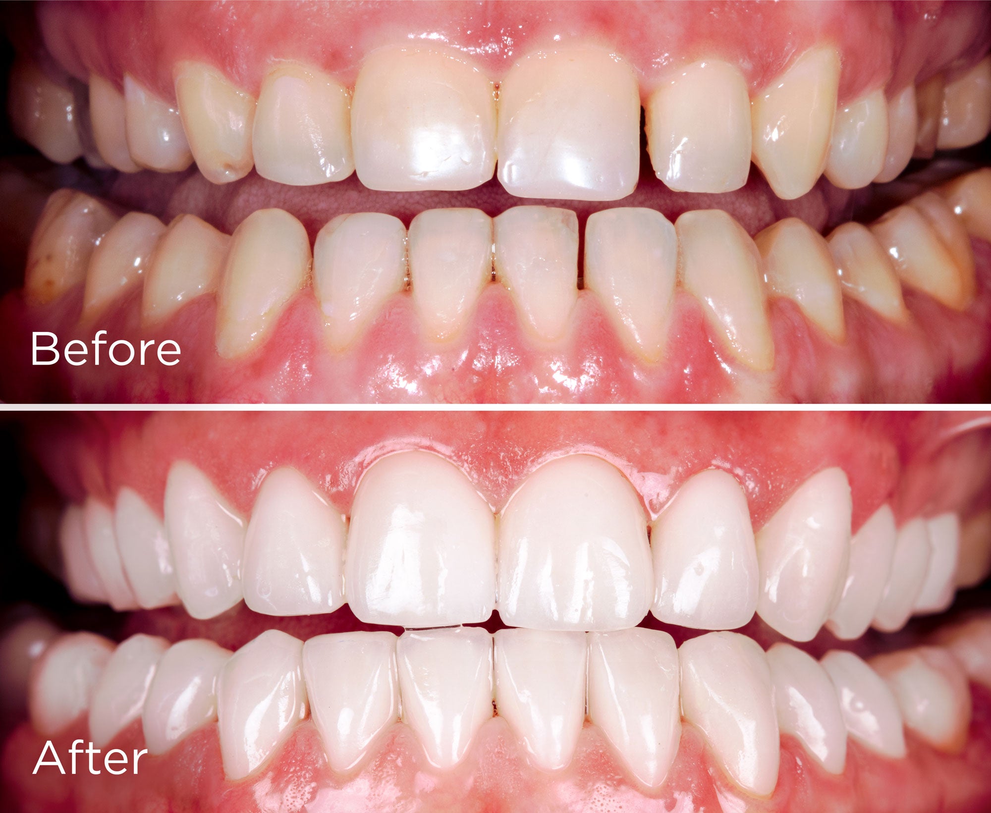 Arctic Mint Dental Floss